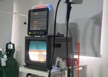 Hospital de Ibiúna inicia exames de endoscopia